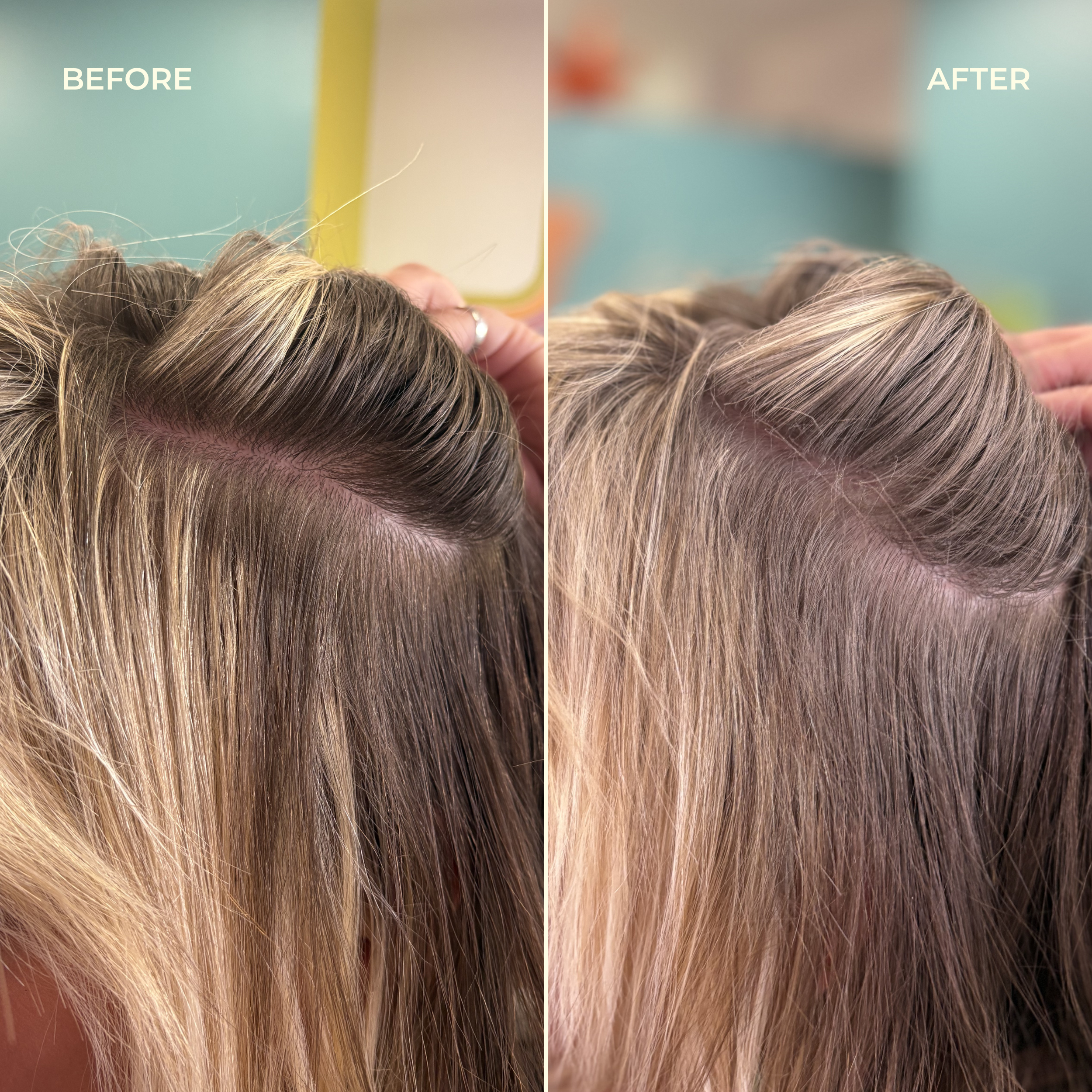 Dry Shampoo Precision Applicator